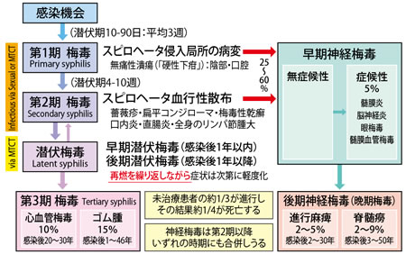 神経 梅毒 症状